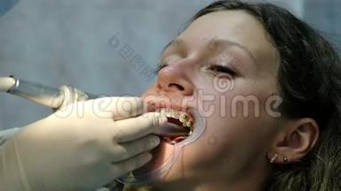 安装金属牙套特写，拜访牙医.. <strong>牙齿矫正</strong>师用工具<strong>矫正牙齿</strong>